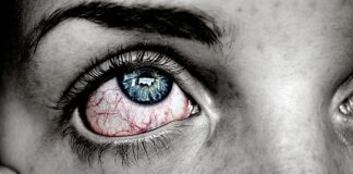 La lepra que acaba con tu vida La lepra que acaba con tu vida